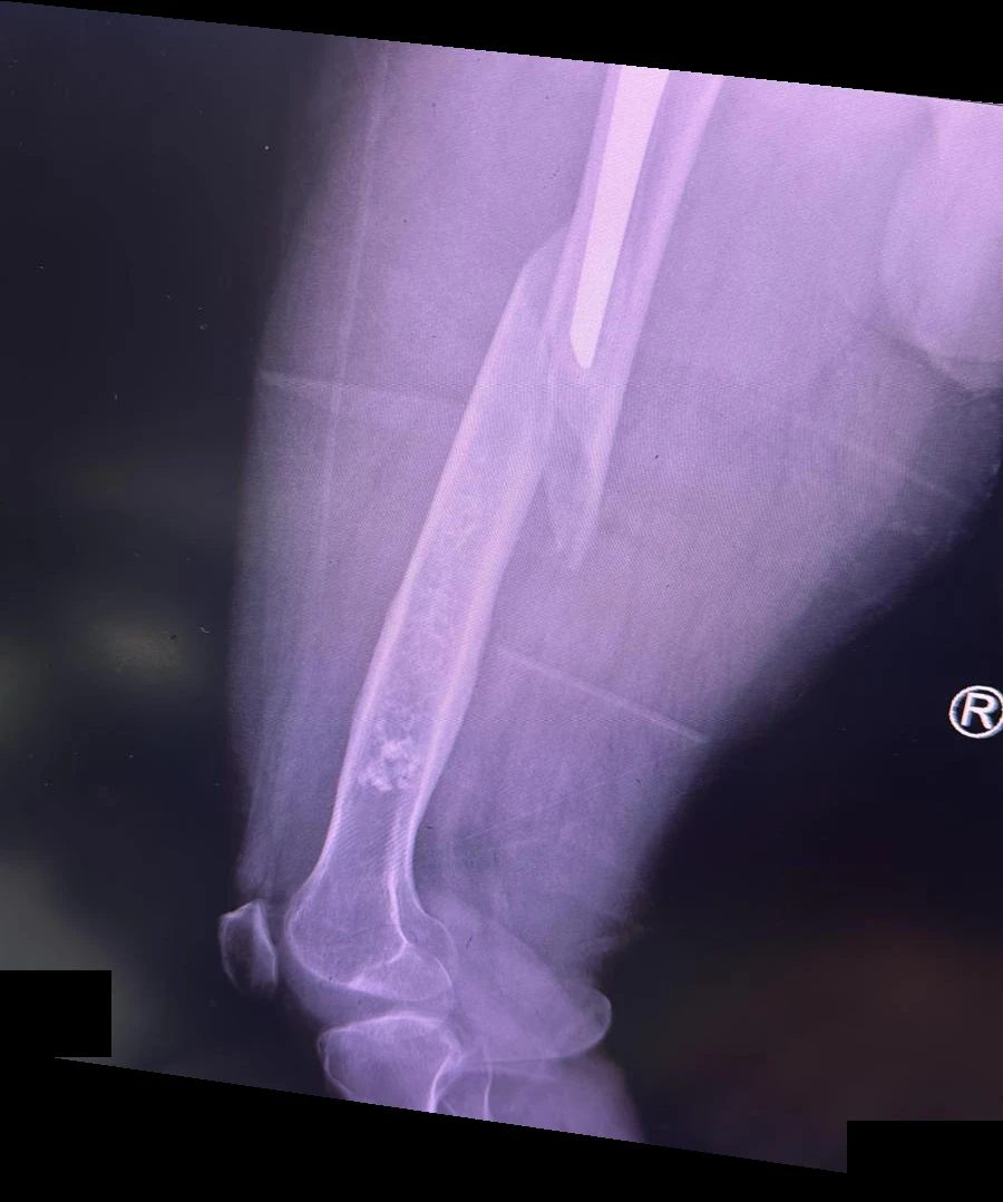 Second X-ray view at presentation