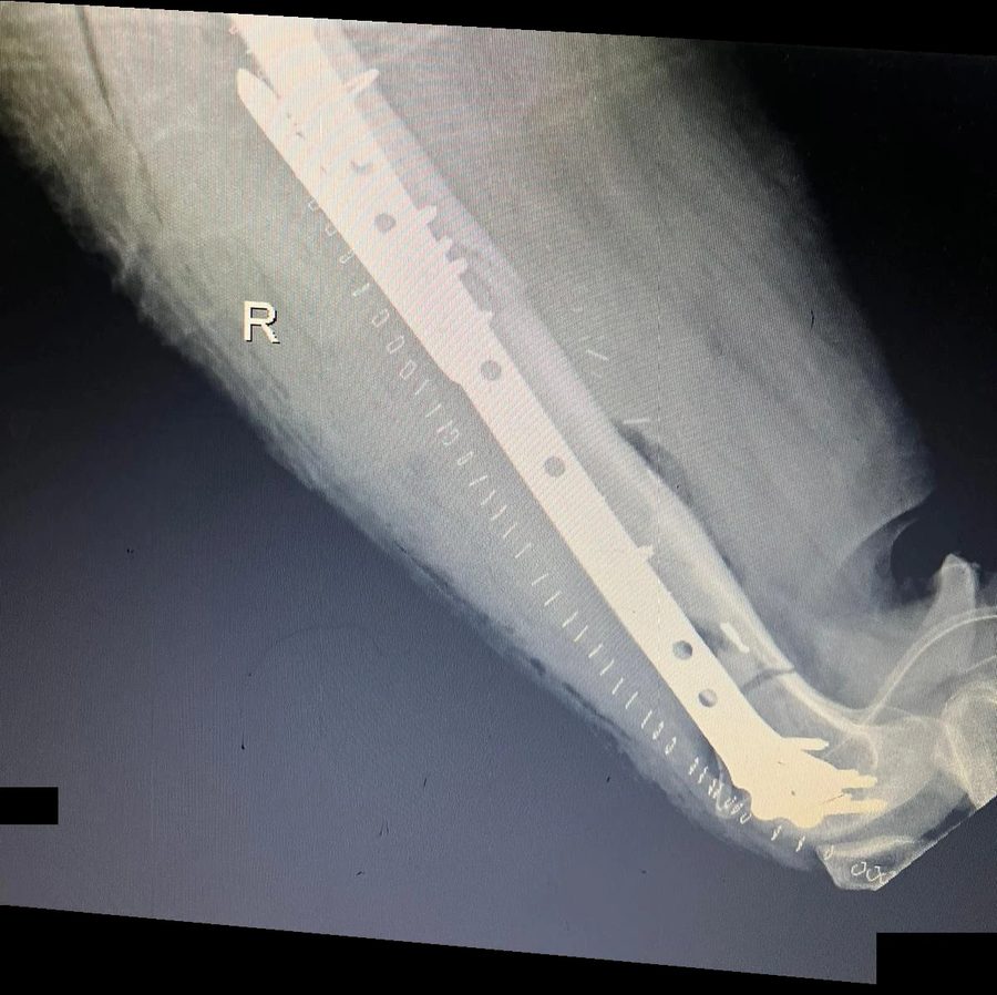 X-ray after reconstruction, side view